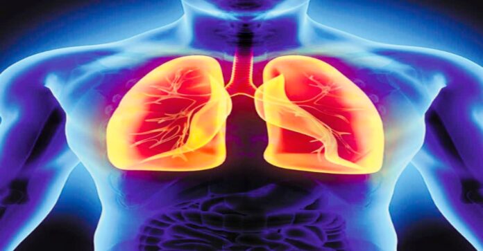 Lung Lavage treatment at NIMS Hyderabad