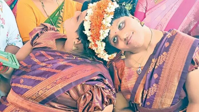 Conjoined twins Veena Vani story