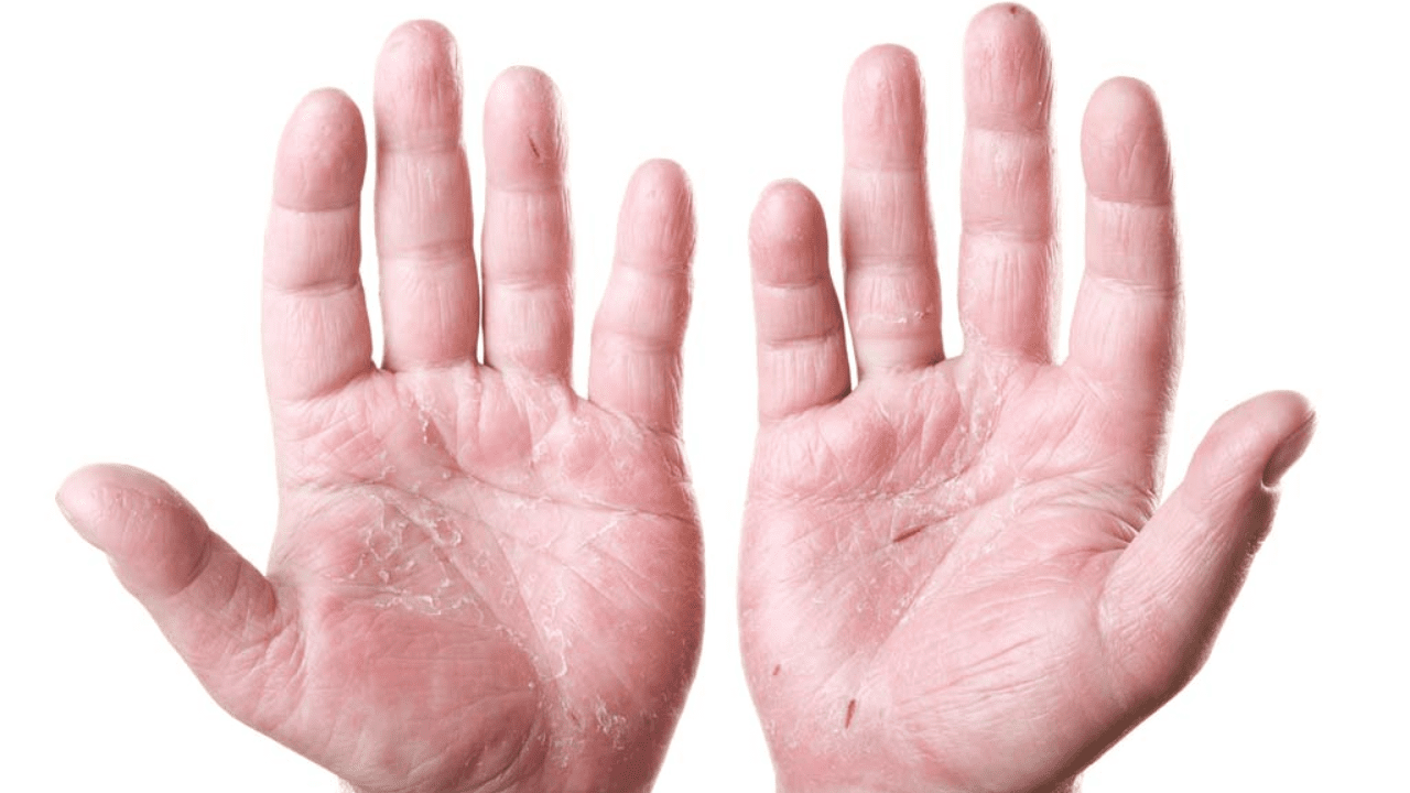Hand Wash skin effect