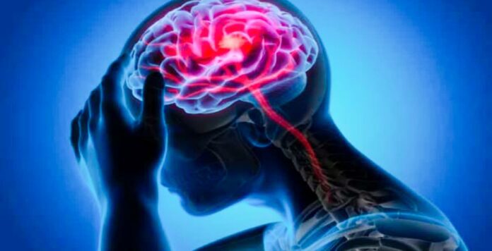 Rising brain stroke cases in youth